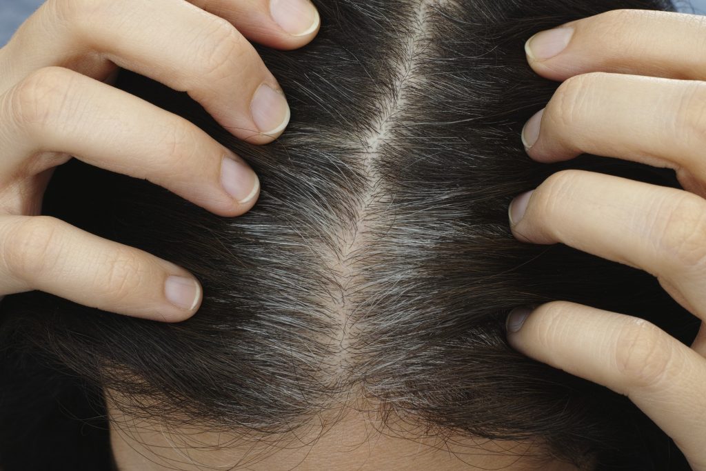 Natural remedies to cure grey hair Beauty Tips By Nim