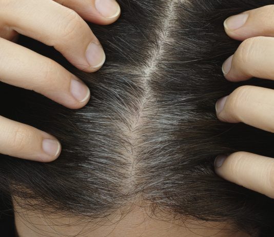 HOW TO CURE GREY HAIR AMONG YOUNGSTERS | Beauty Tips By Nim | Nimisha Goyal | HashBUGS