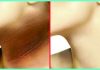 5 NATURAL REMEDIES FOR DARK NECK | Beauty Tips By Nim | Nimisha Goyal | HashBUGS | BTN | beautytipsbynim.hashbugs.com