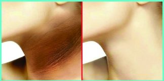 5 NATURAL REMEDIES FOR DARK NECK | Beauty Tips By Nim | Nimisha Goyal | HashBUGS | BTN | beautytipsbynim.hashbugs.com