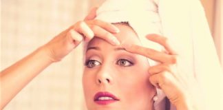 5 Natural Remedies For Whiteheads - Beauty Tips By Nim - Nimisha Goyal - HashBUGS - BTN - beautytipsbynim.hashbugs.com