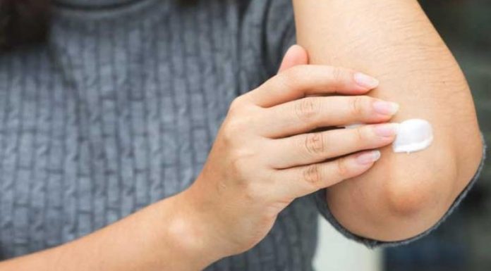 5 Homemade Remedies For Dark Elbows - Beauty Tips By Nim - Nimisha Goyal - HashBUGS - BTN - beautytipsbynim.hashbugs.com