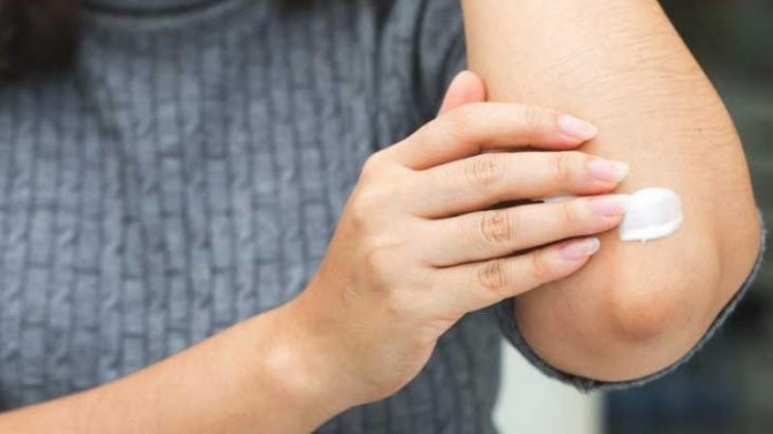 5 Homemade Remedies For Dark Elbows - Beauty Tips By Nim - Nimisha Goyal - HashBUGS - BTN - beautytipsbynim.hashbugs.com