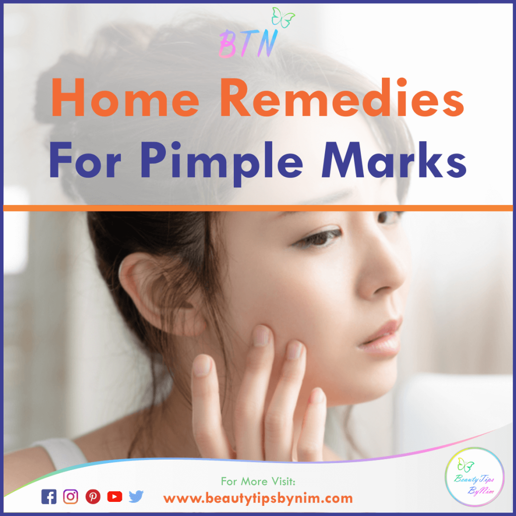 How To Get Rid of Pimple Marks At Home - Natural Remedies - Beauty Tips By Nim - Nimisha Goyal - HashBUGS - BTN - beautytipsbynim.com