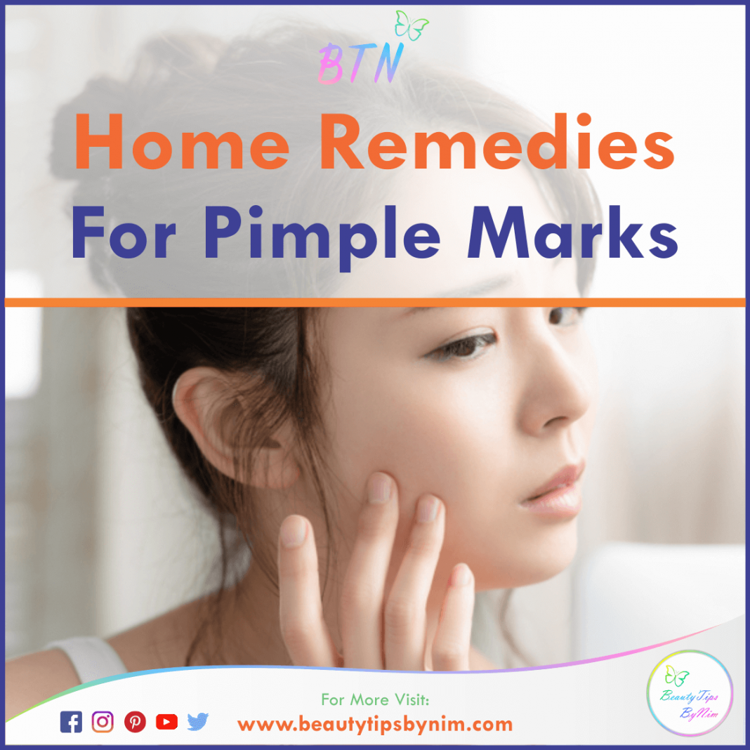 How To Get Rid Of Pimple Marks At Home -Remedies - Beauty Tips By Nim