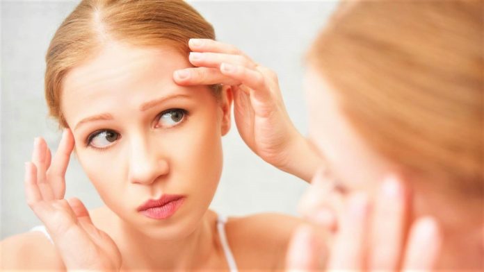 Top 10 Tips on How to Get Rid of Oily T-Zone in Summers - Beauty Tips By Nim - Nimisha Goyal - HashBUGS - BTN - beautytipsbynim.com