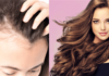 How to Hide Bald Spots And Make Hair Look Voluminous - Beauty Tips By Nim - Nimisha Goyal - HashBUGS - BTN - Nimify Beauty - beautytipsbynim.com