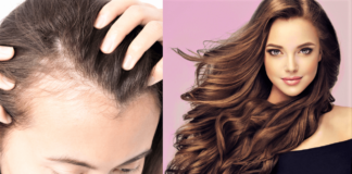 How to Hide Bald Spots And Make Hair Look Voluminous - Beauty Tips By Nim - Nimisha Goyal - HashBUGS - BTN - Nimify Beauty - beautytipsbynim.com