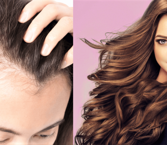 How to Hide Bald Spots And Make Hair Look Voluminous - Beauty Tips By Nim - Nimisha Goyal - HashBUGS - BTN - Nimify Beauty - beautytipsbynim.com
