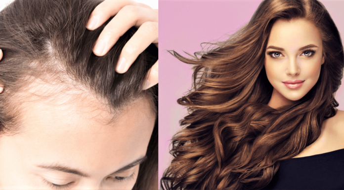 How to Hide Bald Spots And Make Hair Look Voluminous - Beauty Tips By Nim - Nimisha Goyal - HashBUGS - BTN - Nimify Beauty - beautytipsbynim.com