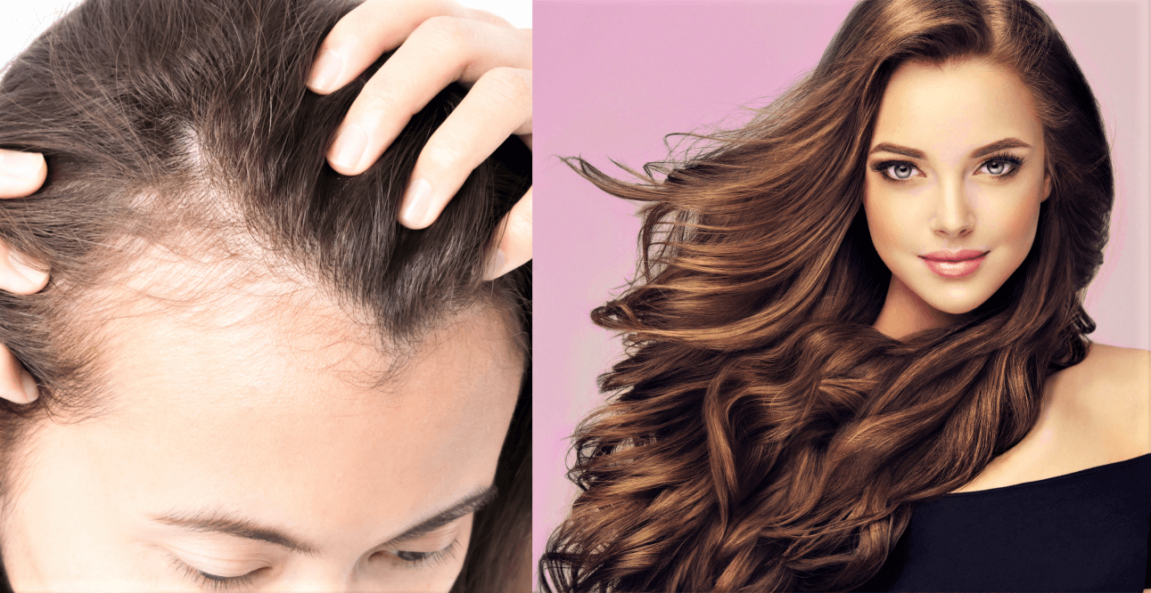 How to Hide Bald Spots & Make Hair Look Voluminous-Beauty Tips By Nim