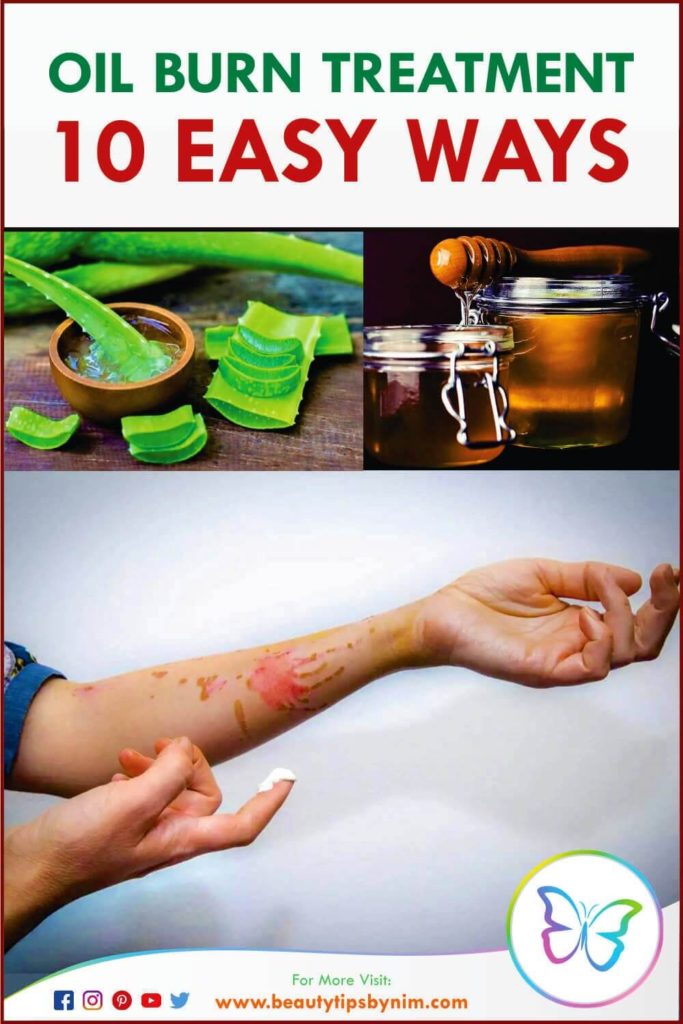 Oil Burn Treatment 10 Easy Ways to Treat It Beauty Tips By Nim