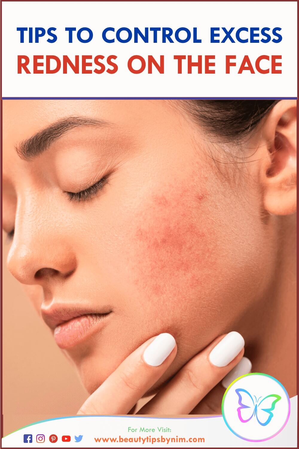 Tips to Control Excess Redness on the Face With Pictures - Beauty Tips By Nim - Nimisha Goyal - HashBUGS - BTN - Nimify Beauty - beautytipsbynim.com