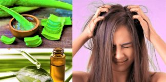 How To Care For Sensitive Scalp and Precautions - Beauty Tips By Nim - Nimisha Goyal - HashBUGS - BTN - Nimify Beauty - beautytipsbynim.com