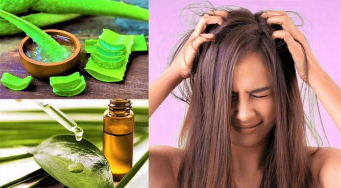 How To Care For Sensitive Scalp and Precautions - Beauty Tips By Nim - Nimisha Goyal - HashBUGS - BTN - Nimify Beauty - beautytipsbynim.com