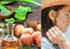 Best Homemade Remedies for Sun Burn - Beauty Tips By Nim - Nimisha Goyal - HashBUGS - BTN - Nimify Beauty - beautytipsbynim.com