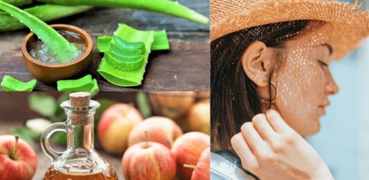 Best Homemade Remedies for Sun Burn - Beauty Tips By Nim - Nimisha Goyal - HashBUGS - BTN - Nimify Beauty - beautytipsbynim.com