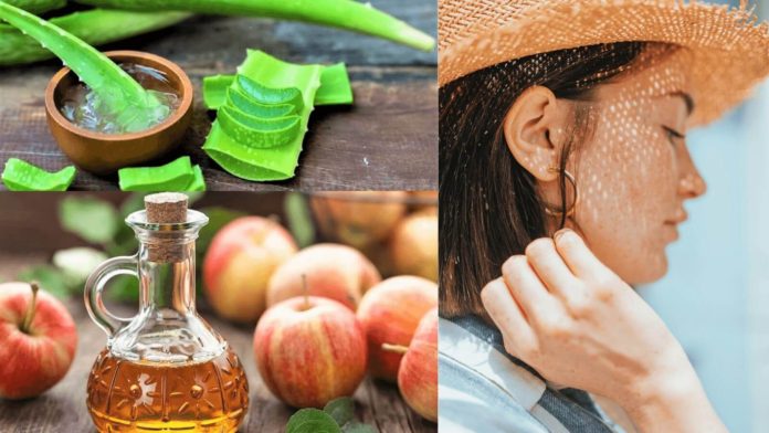 Best Homemade Remedies for Sun Burn - Beauty Tips By Nim - Nimisha Goyal - HashBUGS - BTN - Nimify Beauty - beautytipsbynim.com